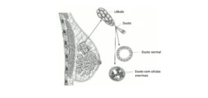 Infográfico apresenta estrutura da mama - lobo e duto