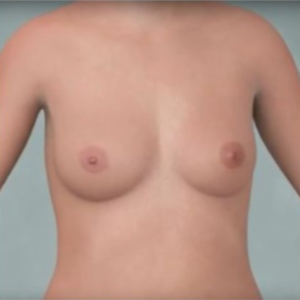 Ilustração das mamas