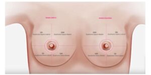 Ilustração apresenta os quadrantes da mama