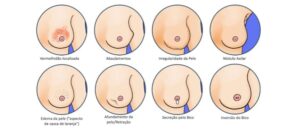 imagem apresenta os sinais e sintomas