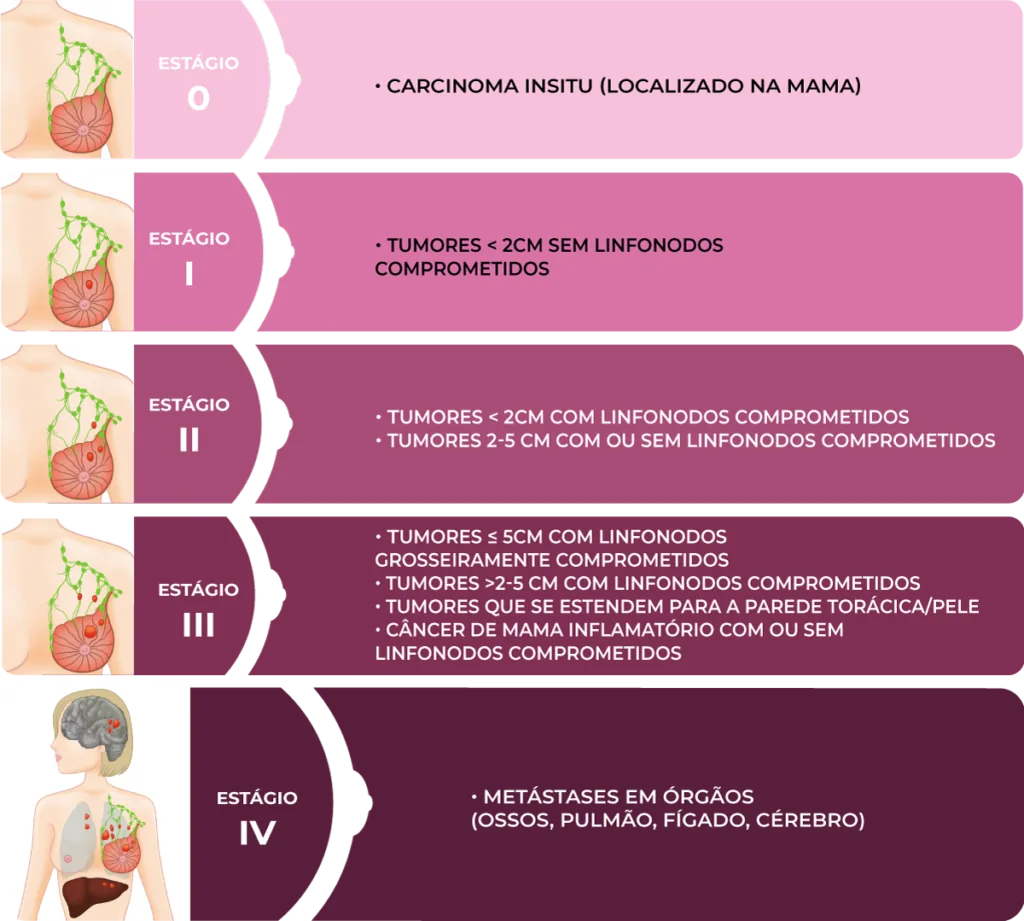 Estágios do câncer de mama