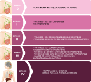 Estágios do câncer de mama